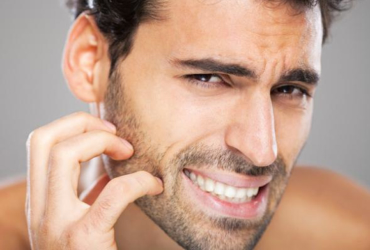 Winter Skin Care Tips For Men in Hindi: