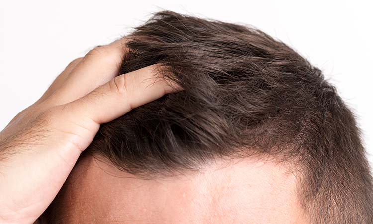 hair care mistakes by men