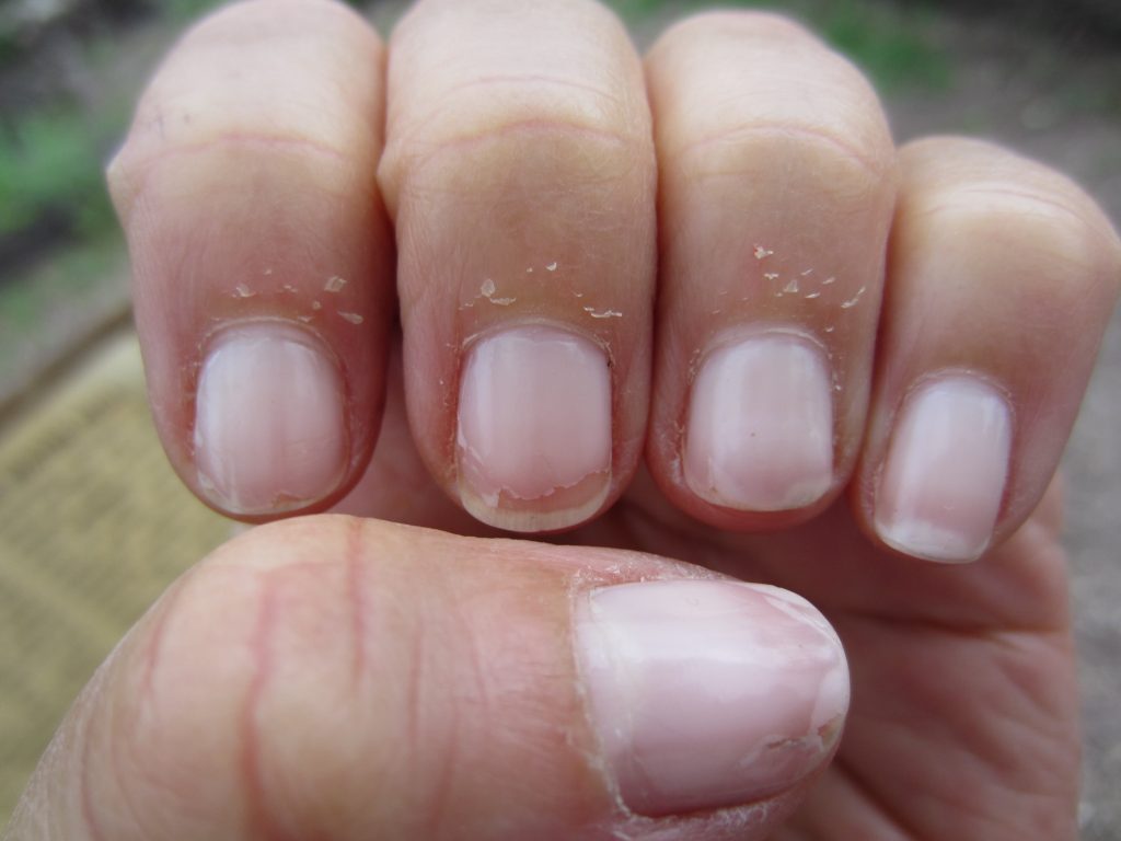 Cuticles