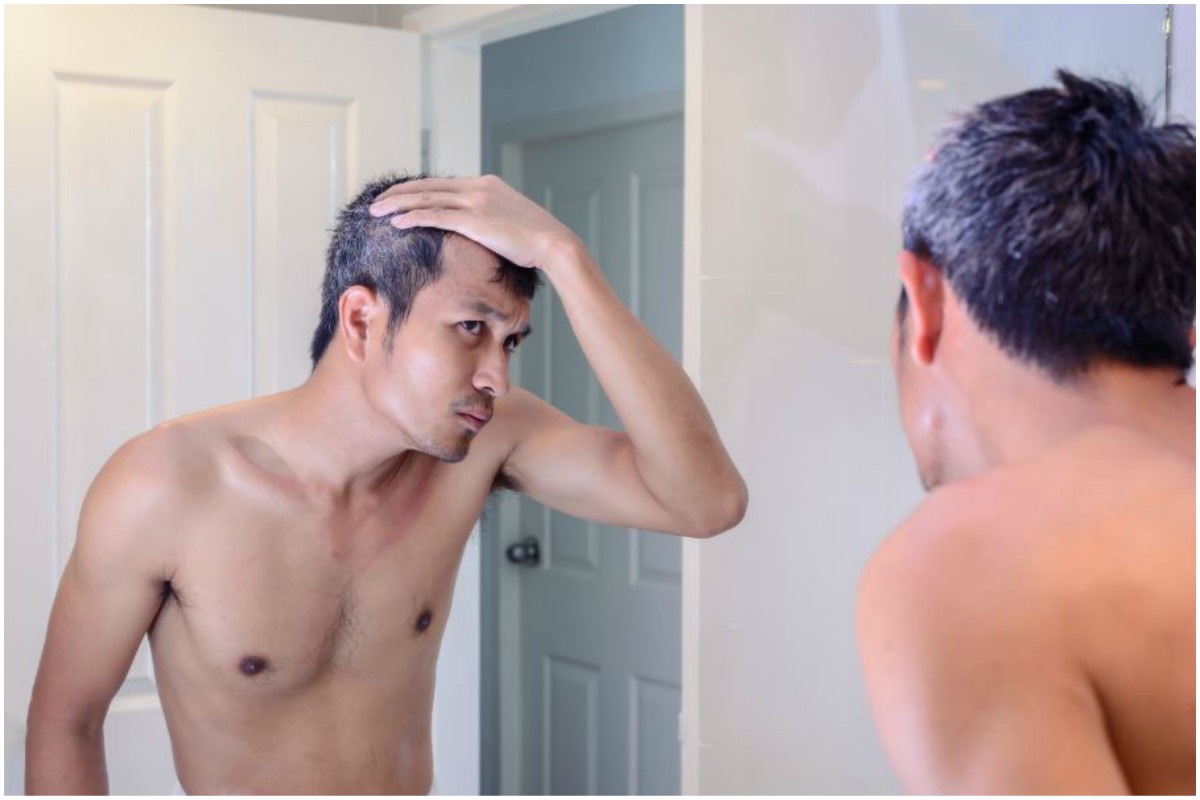 What Causes Premature Greying In Men