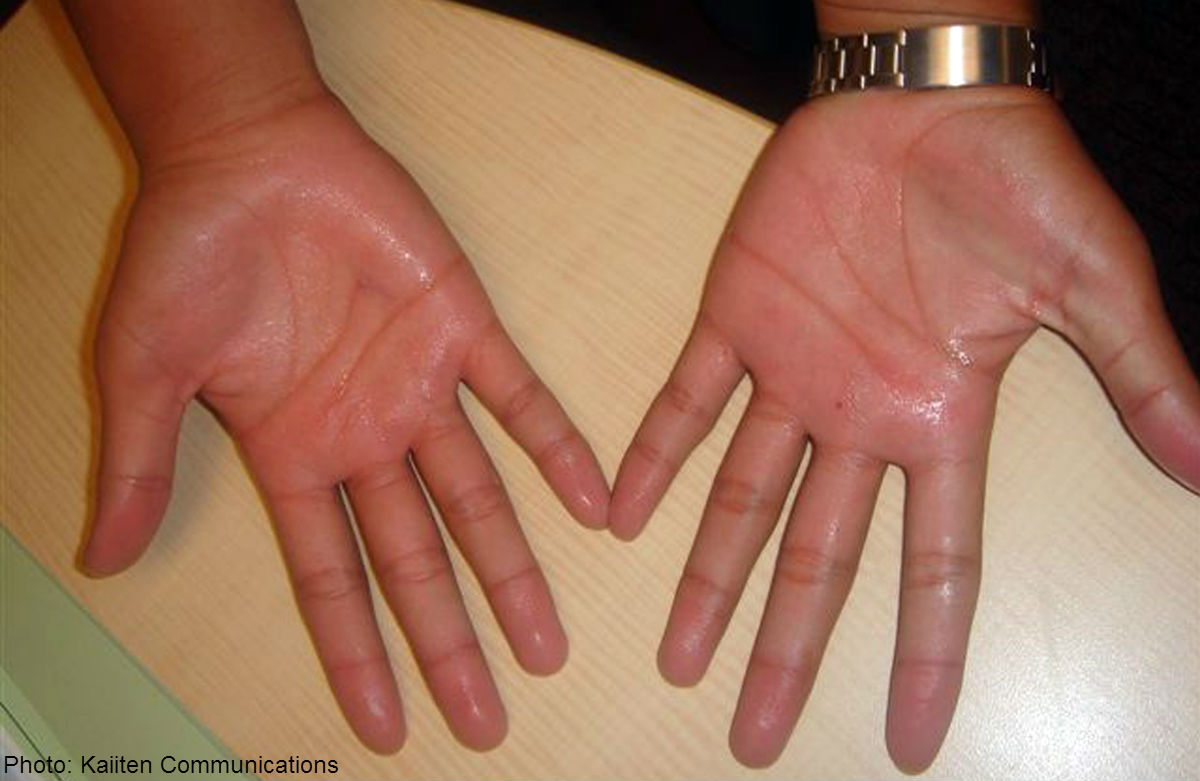 Tips To Get Rid Of Sweaty Hands

