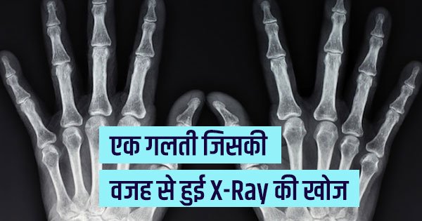 एक गलती जिसकी वजह से हुई X-Ray की खोज
