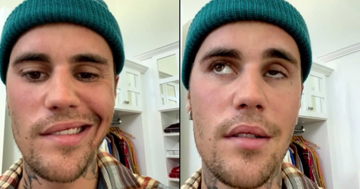 Justin Bieber Paralyzed: क्या है Ramsay Hunt Syndrome, जिसके चलते ...