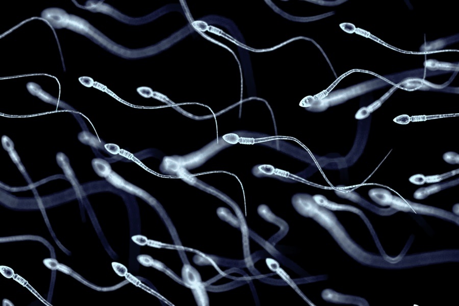 Male inFertility